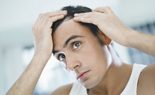 Saç neden dökülür, saç dökülmesi nedenleri nelerdir? içeriğine ait görsel