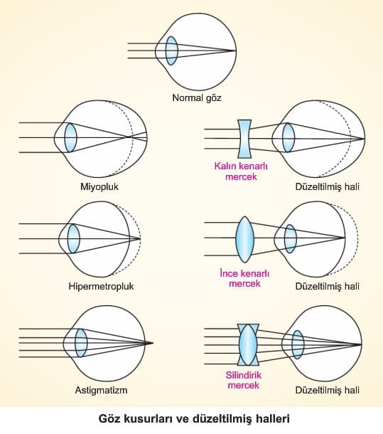 Goz Kusurlari Konu Anlatimi Ders Notu 11 Sinif Biyoloji
